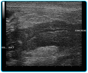 Feline Pancreas being Ultrasounded